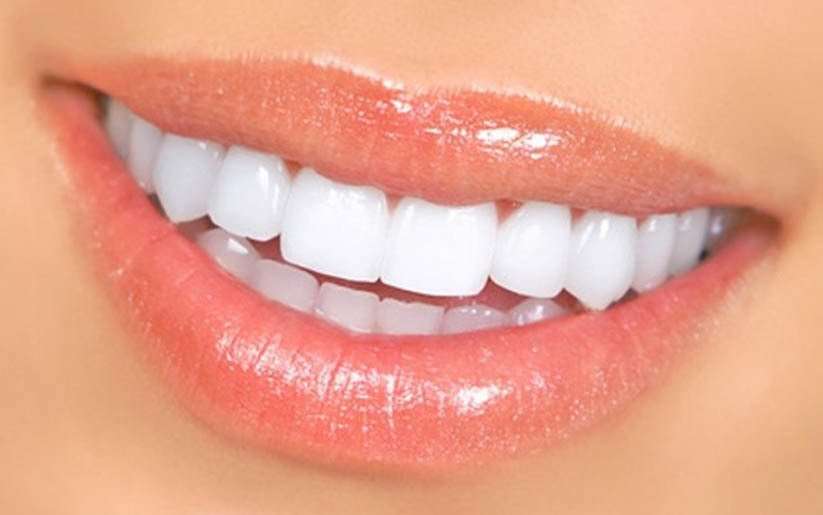 dents