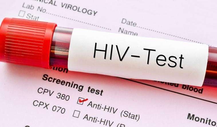 sida test